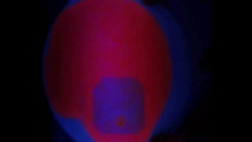 Photoprotektion von β-Carotin gegenüber Chlorophyll Photoprotektion von β-Carotin gegenüber Chlorophyll